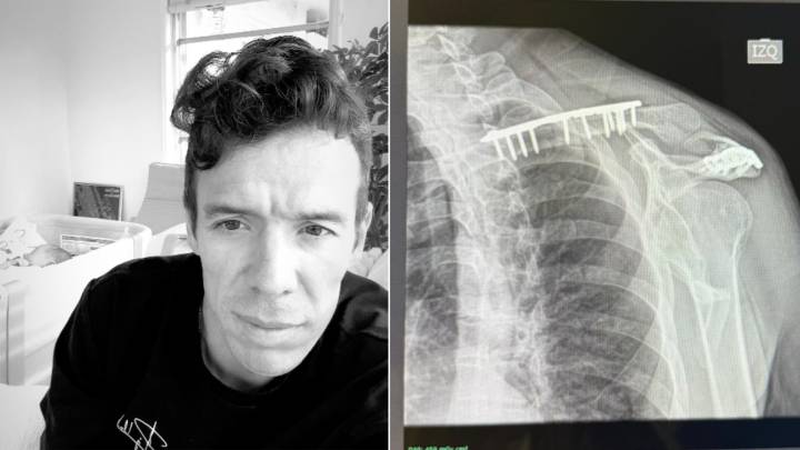 ¡Tremenda ‘chamba’! Rigoberto Urán muestra la cicatriz que le dejó su insólito accidente con la bicicleta de su hija
