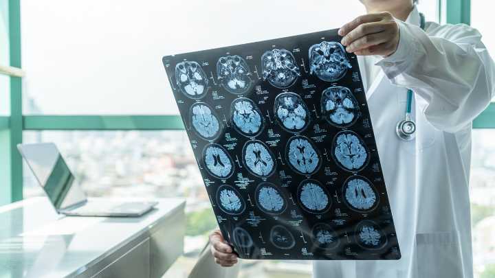 Scientists Say This “Dirt Cheap” Treatment Could Reverse Alzheimer’s Disease