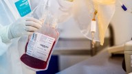 New Tool Guides Blood Cancer Txs For Patients 60+