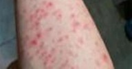 Horror pics of 'new Chinese pandemic' emerge as quarantine imposed after 10,000 cases