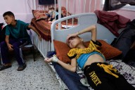 At Gaza’s Nasser Hospital, doctors treat malnourished children daily