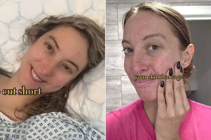 Woman, 37, with Terminal Brain Cancer Celebrates Wrinkles