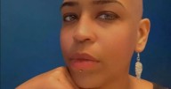 'I thought I just had toothache, then a shock diagnosis changed my life forever'