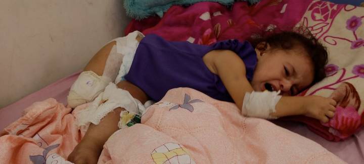 Driven by hunger in Gaza, amputees are part of the collateral damage