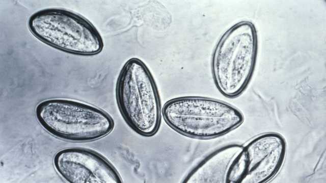 Do you need to cleanse your body of parasites? A doctor explains the social media fad