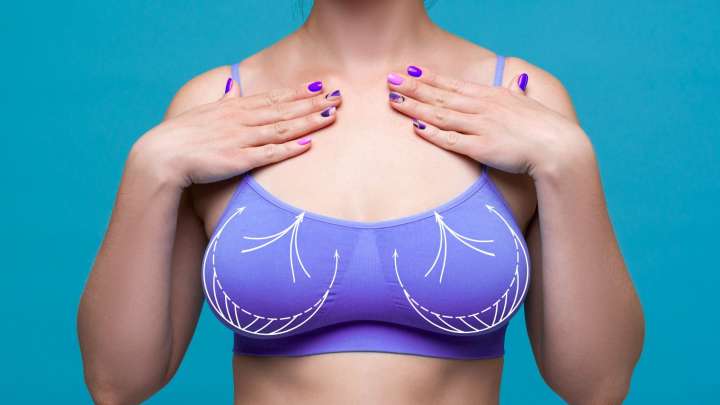 Uplifting boob op that prevents sagging thanks to 'internal scaffold' made of pig skin could be the ‘end for bras’
