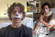 Hero American tourist and model reveals extent of facial injuries suffered while defending two women in Germany