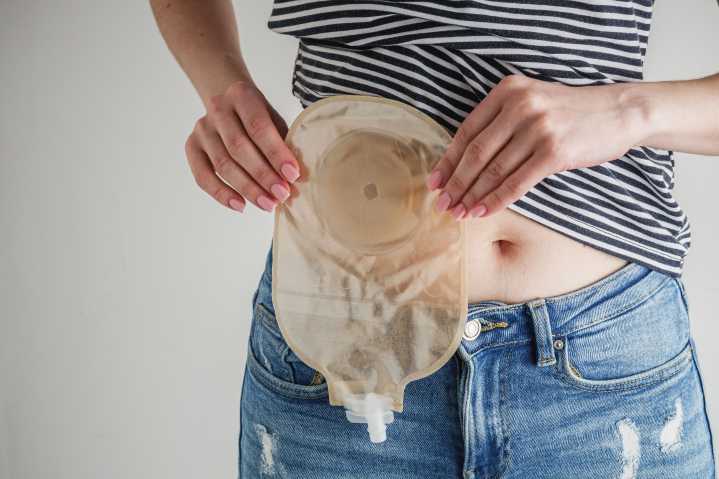 Boosting Colorectal Cancer Screening in Young Adults: An Unsolicited FIT Kit May Be the Answer
