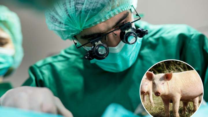 First ever pig lung transplant works in human for nine days - op could ‘alleviate current organ shortage’