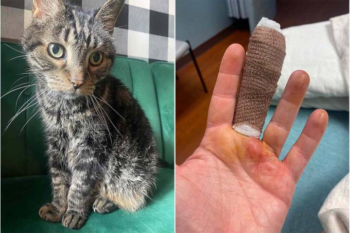 Woman Spends Days in the Hospital After Cat Scratches Her Finger (Exclusive)