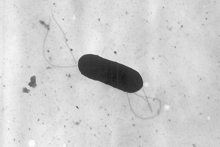 Listeriosis. De qué se trata la enfermedad bacteriana detectada en un queso que alertó al Ministerio de Salud