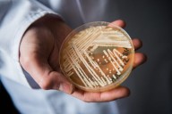 Candida auris cases nearly triple as deadly fungus spreads to new states