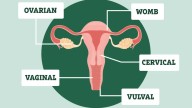 Do YOU know the ‘red-flag’ symptoms of 5 gynae cancers? Test your knowledge now – it might save your life