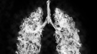 This lung disease can be dangerous for younger people, too