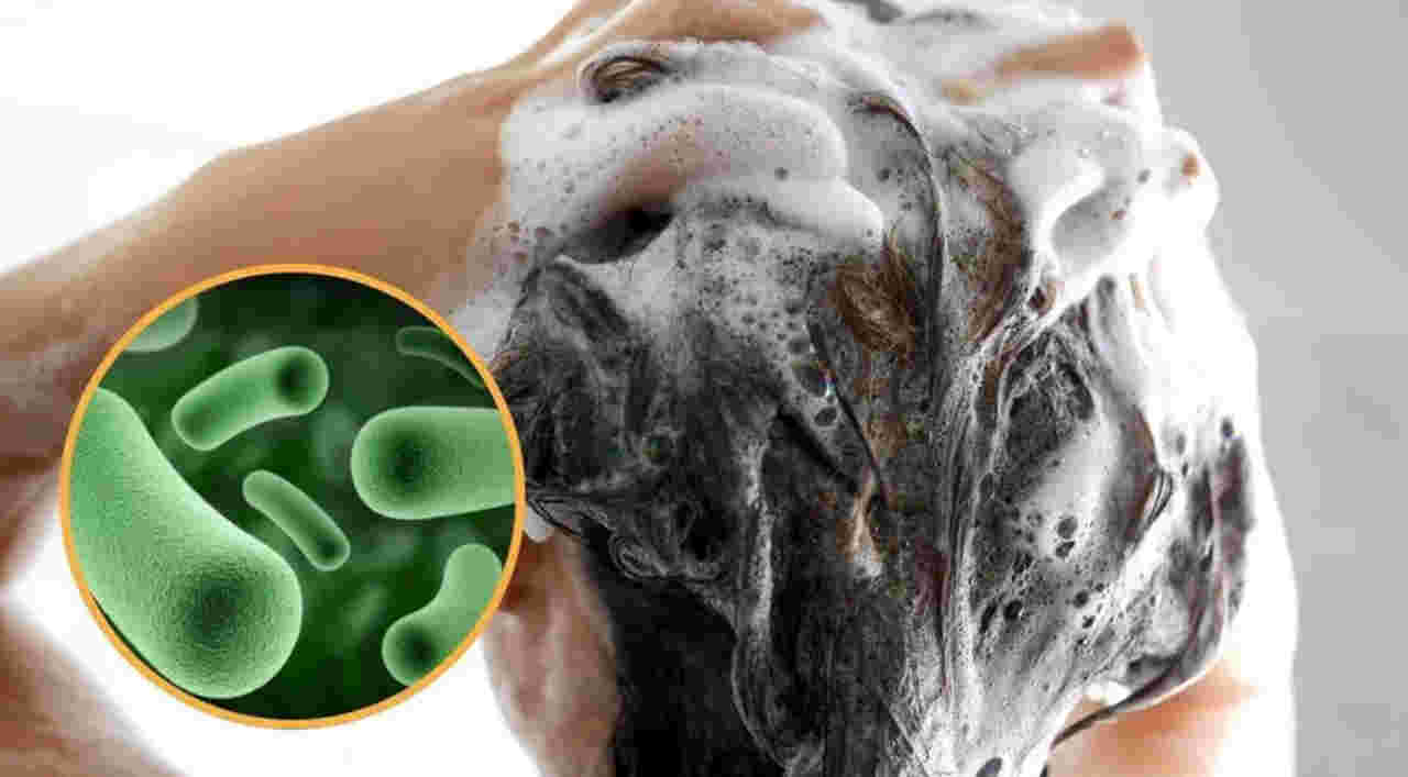 PROFECO alerta por shampoo contaminado; puede provocar infecciones oculares, nasales y en la piel