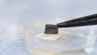 At-home skin cancer test could be one step closer