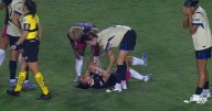 Charlyn Corral recibe fuerte patada de Mapi León y sale del partido con la cara llena de sangre (VIDEO)