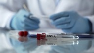 Descubren el camino para hacer el primer el antiviral de amplio espectro