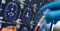 Morning tea or coffee could slash risk of Alzheimer’s disease