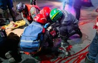 Hombre pierde una pierna al colisionar contra la defensa en la ARC