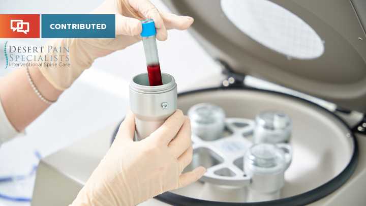 Nature’s own healing, delivered with precision: A physician’s take on platelet