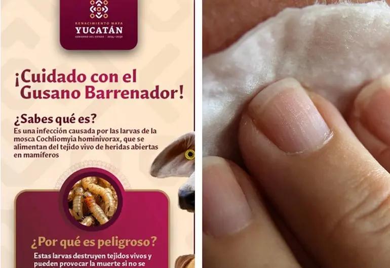 Yucatán reporta primer caso humano infectado por gusano barrenador del ganado