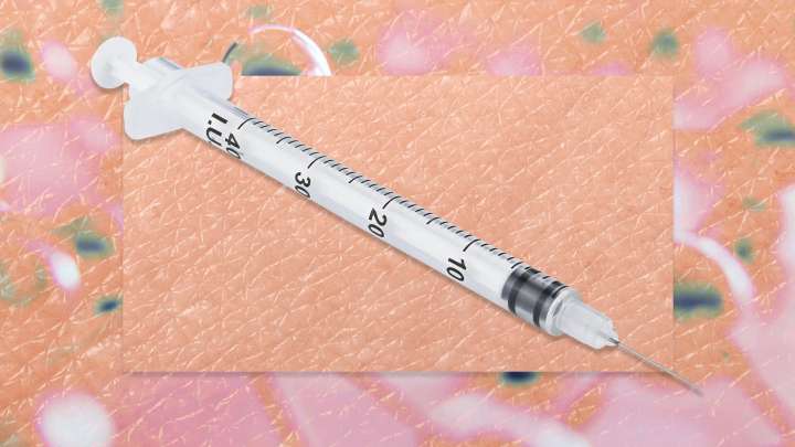 Cash-strapped young women are turning to DIY Botox. That’s as scary as it sounds