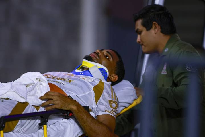 Joaquim Pereira no recuerda el accidente sufrido ante Mazatlán