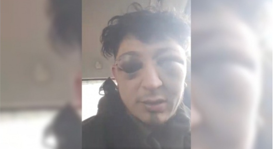 La Policía una vez más apuntada: músico denunció brutal golpiza