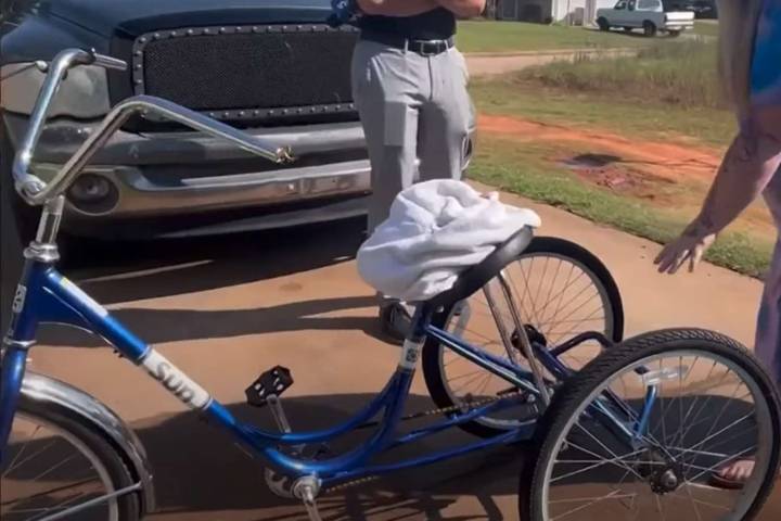 3-Year-Old Boy Loses Finger in Tricycle Accident