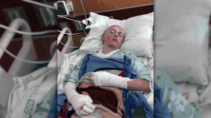 Texas boy hospitalized after TikTok experiment goes wrong