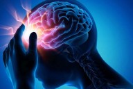 Microinfartos cerebrales: causas, síntomas y prevención