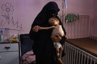 La cifra de niños muertos por desnutrición en Gaza se eleva a 100
