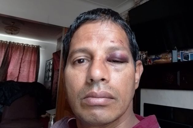 ‘Indians are feeling terrorised’ – chef attacked and robbed on his way to work