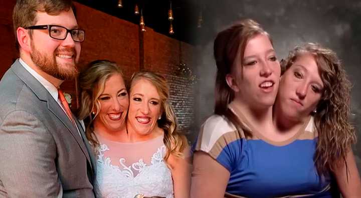 Abby y Brittany Hensel fueron fotografiadas con un bebé y generaron enigmáticas dudas sobre su vida privada