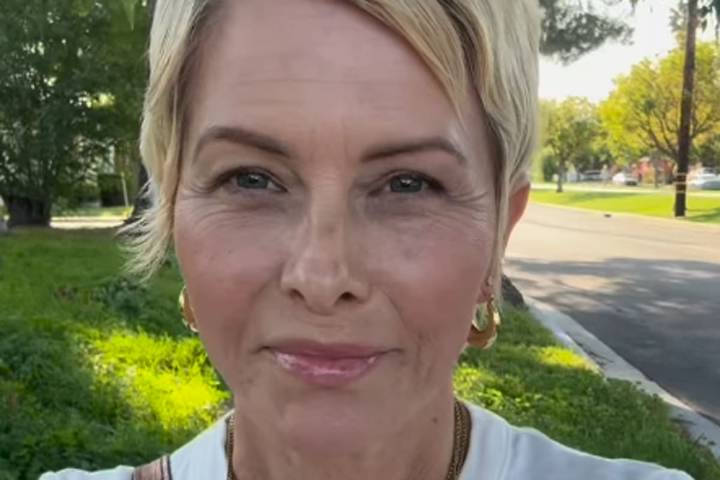 “¿Cómo fue tu fin de semana?". La estrella de Baywatch Nicole Eggert contó que se sometió a una mastectomía