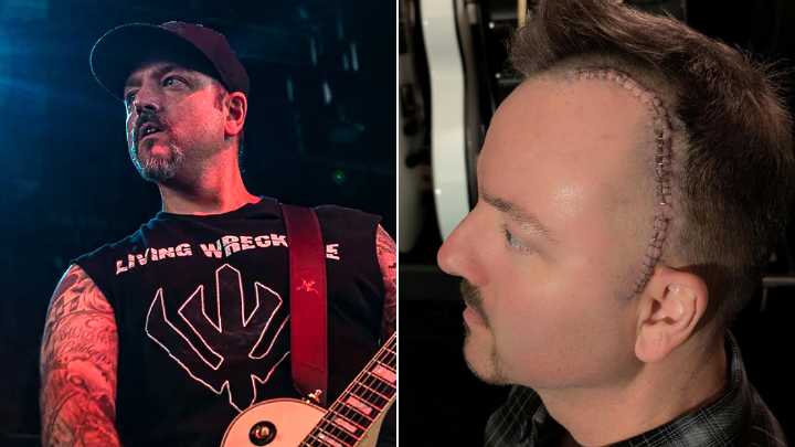 Hatebreed's Wayne Lozinak "Getting Better Every Day" After Removal of Benign Brain Tumor