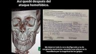 Brutal golpiza a un joven gay en Palermo