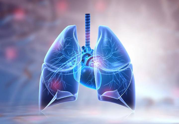 FDA Approves First Drug for Chronic Lung Condition Bronchiectasis