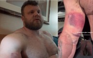 Tom Stoltman Reveals Bicep Injury Following an Eighth-Place Finish at 2025 Strongest Man On Earth – Fitness Volt