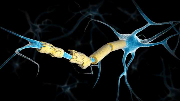 Multiple Sclerosis: Regenerative Target Found in Glial Cells