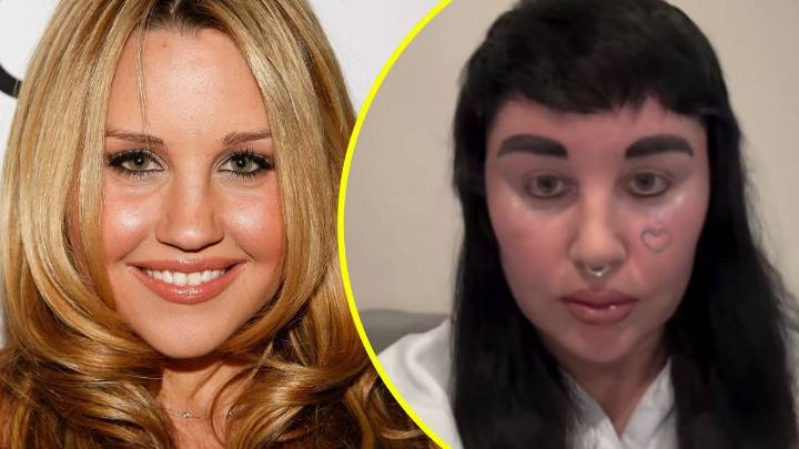 Exestrella juvenil Amanda Bynes sorprende con nueva apariencia tras someterse a tratamiento estético