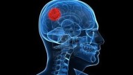 Detectan un cáncer después de que el paciente empezara a oler algodón de azúcar de forma aleatoria