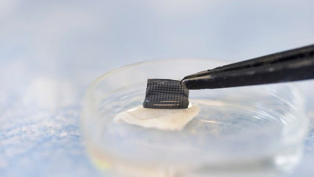 At-home skin cancer test could be one step closer