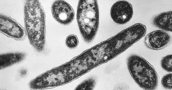 What to know about Legionnaires' disease