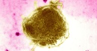 Spokane Regional Health District warns of possible measles exposure in Spokane County