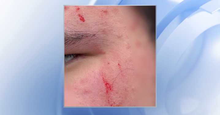 Road rage: Man charged with assaulting 16
