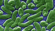 Se disparan las infecciones de bacteria "come carne" en EE.UU: seis muertos