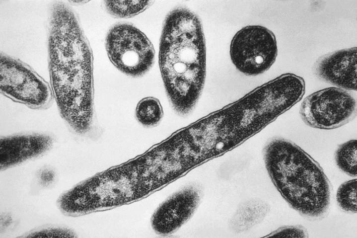 What to know about Legionnaires’ disease