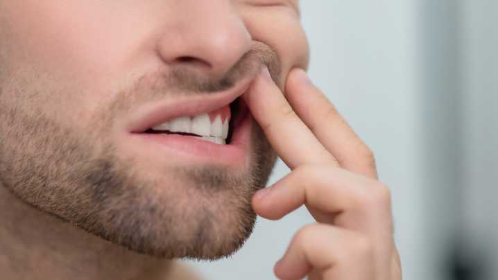 Qué significa si te sangran las encías al cepillarte: posibles causas y cómo actuar